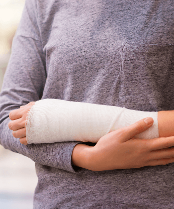 A person holding a broken arm in a cast
